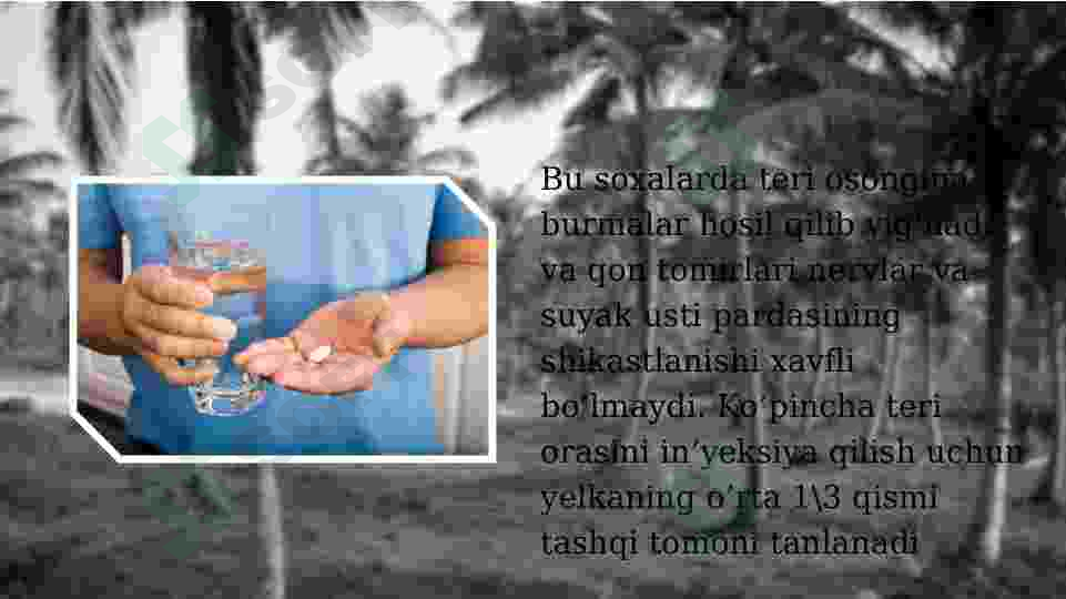 Preview 8
