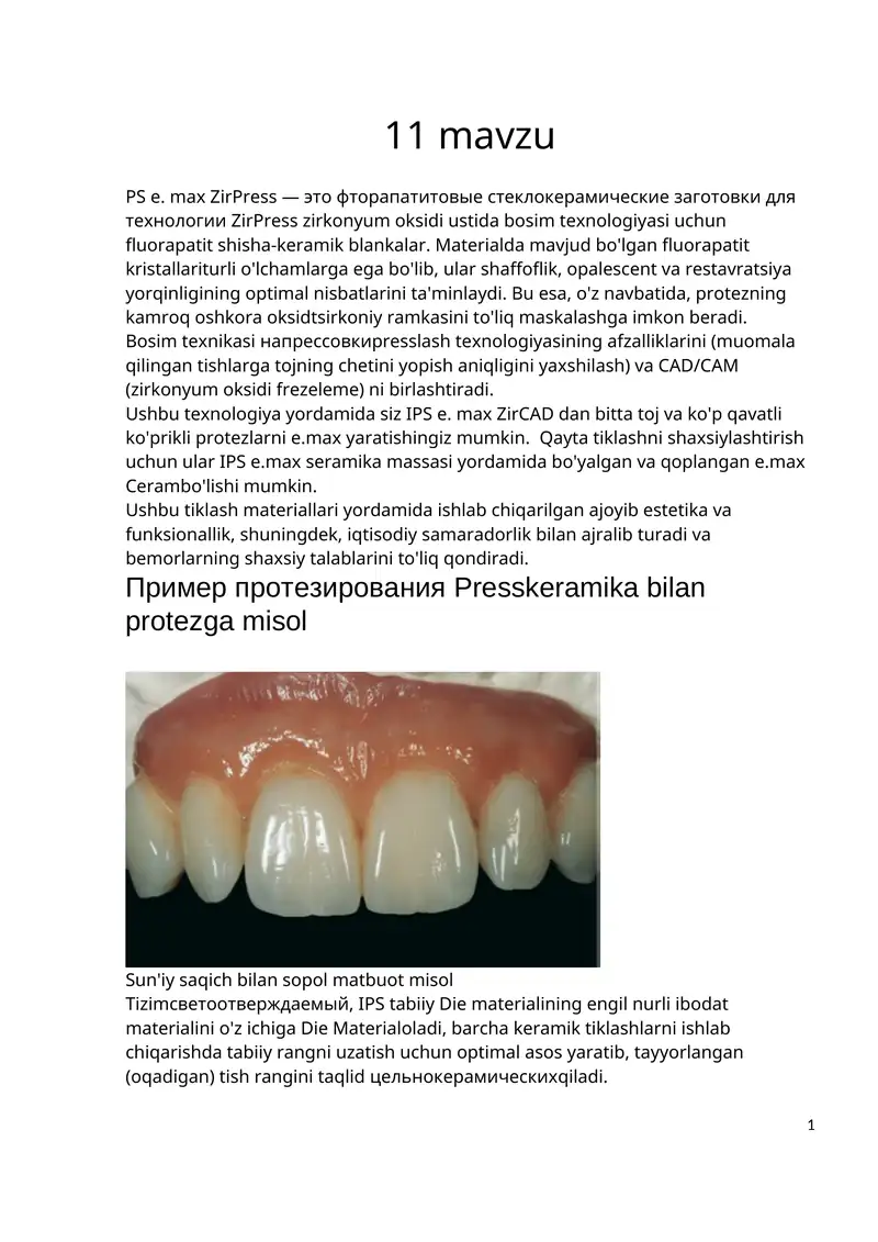 Preview 1