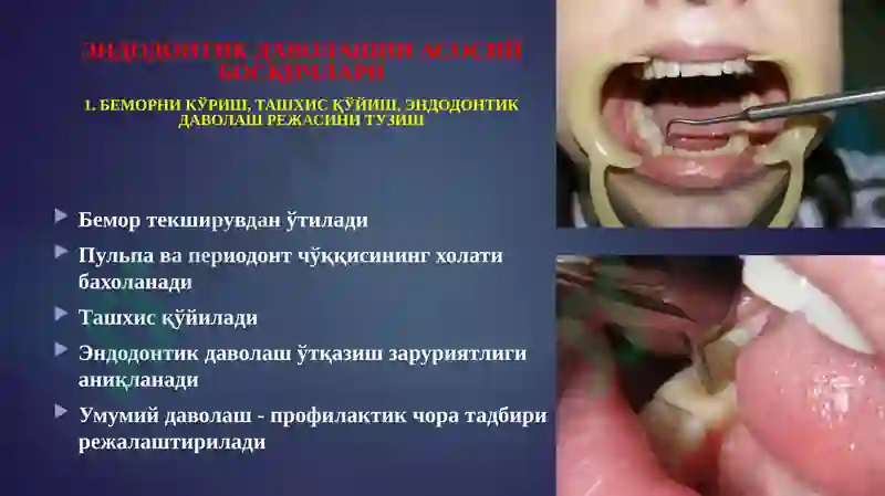 Preview 5