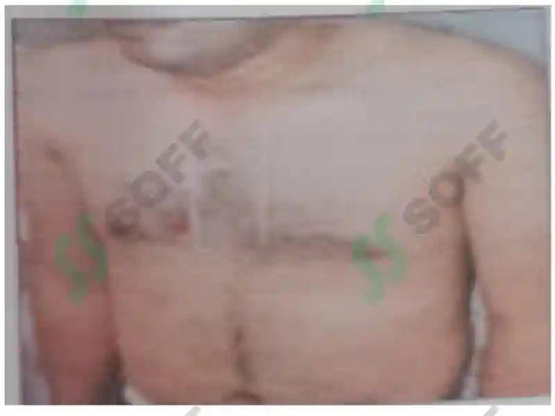 Preview 6