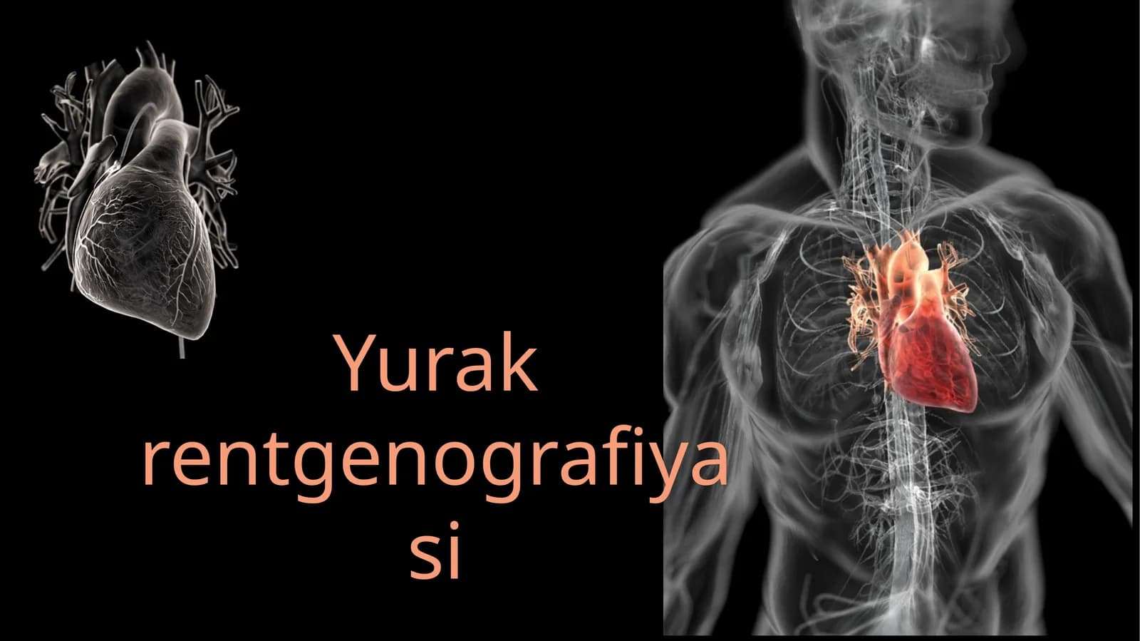 Yurak rentgenografiyasi