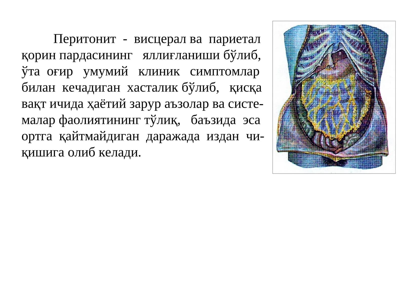 Перитонит-висцералвапариеталқор